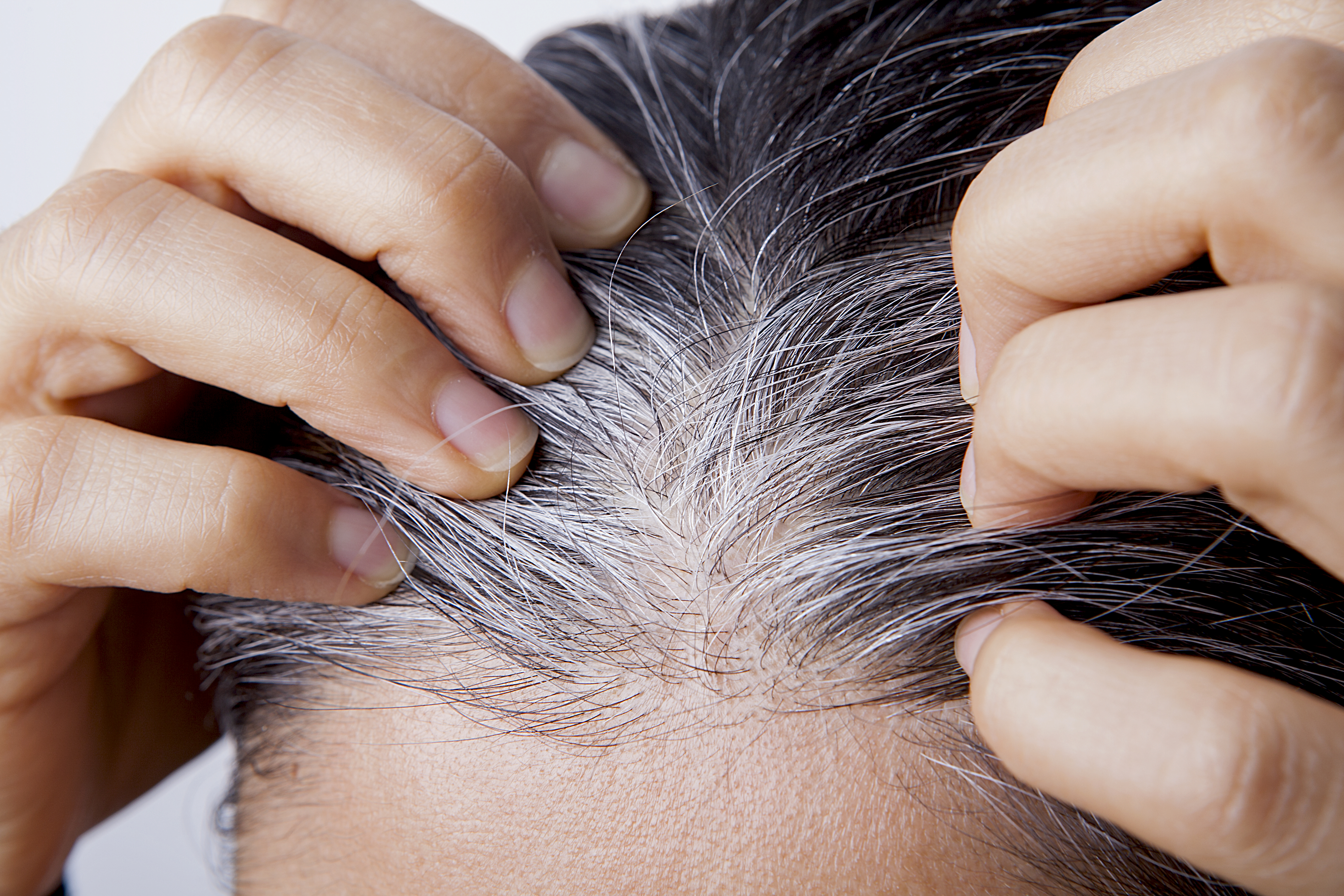 Are There Fruit & Vegetables That Reverse Gray Hair? | livestrong