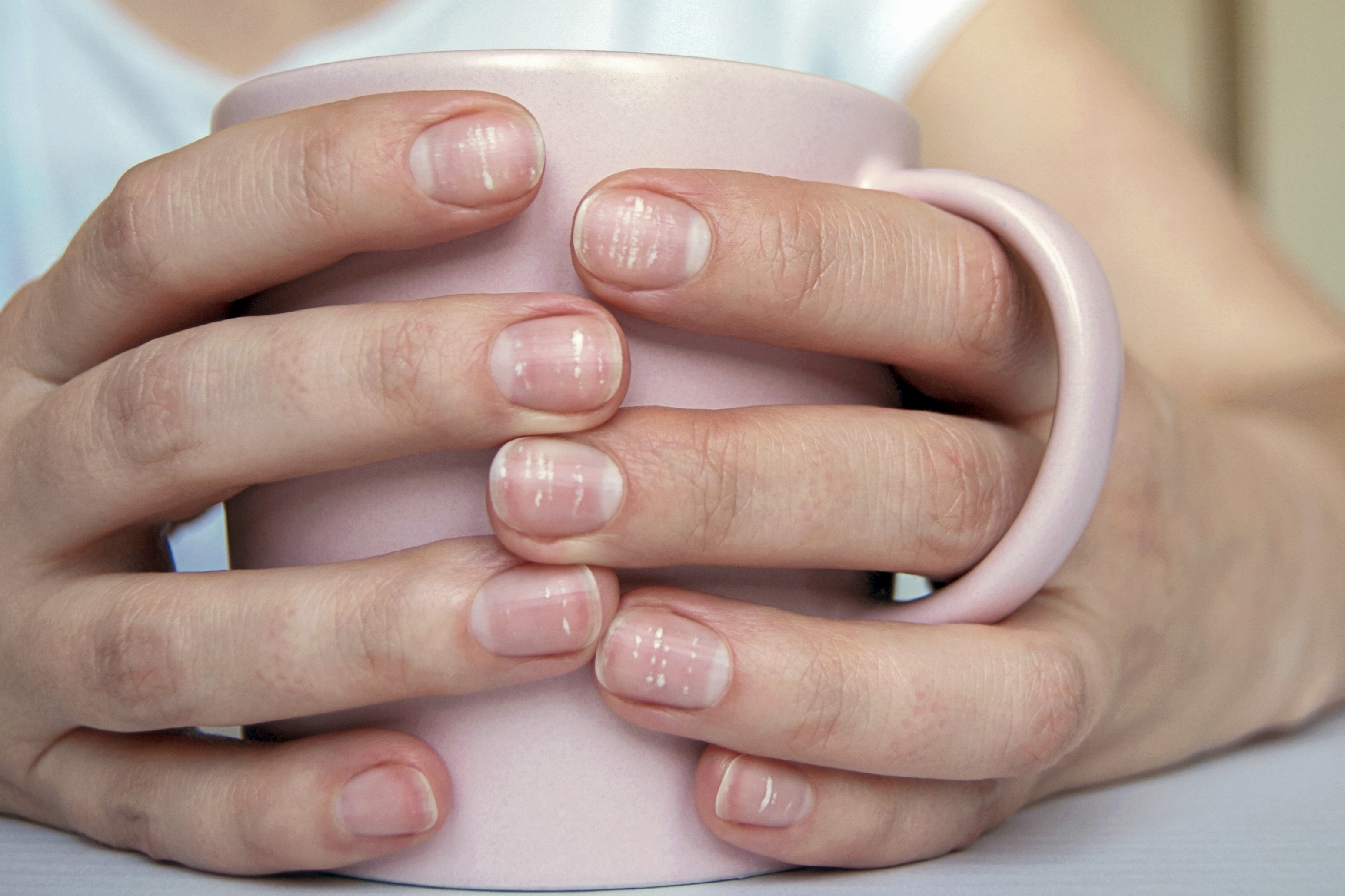 What Causes Fingernails to Split Down the Middle? | livestrong